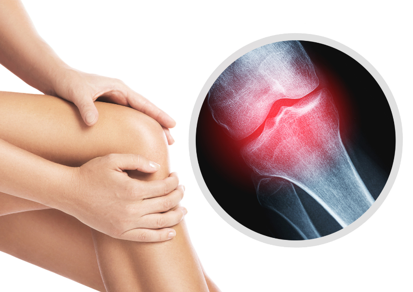 Maintaining Strong Bones and Joints: Your Guide to Optimal Bone and Joint Health